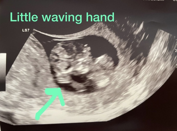 Due June 2022 (thread four)