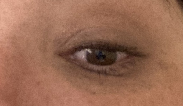 Help my eyes! With picture!