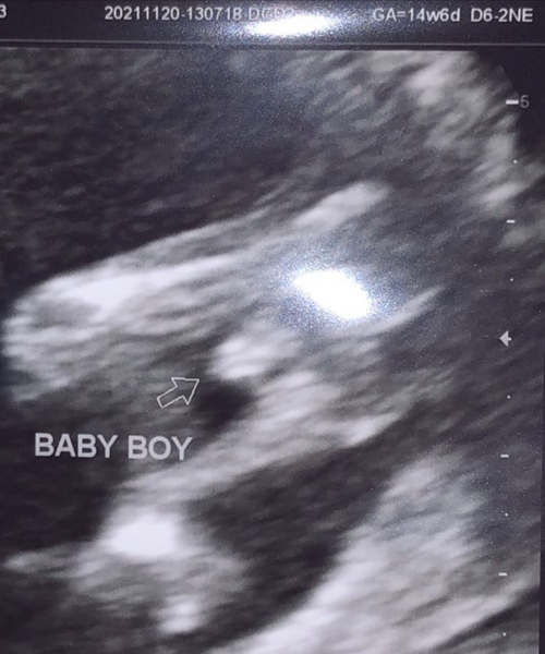 Gender scan query
