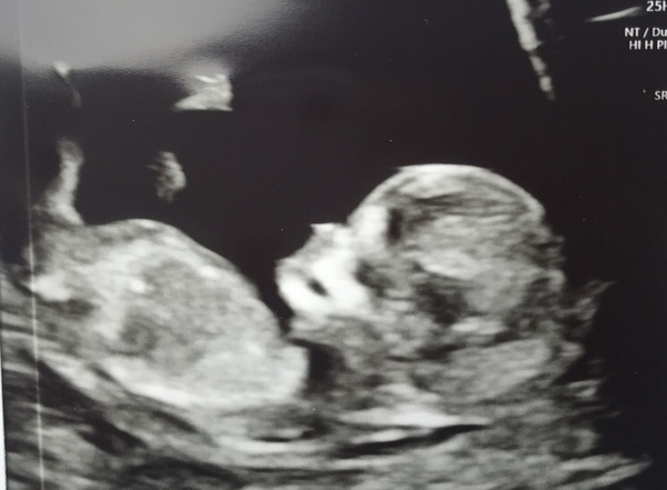 Due June 2022 (thread four)