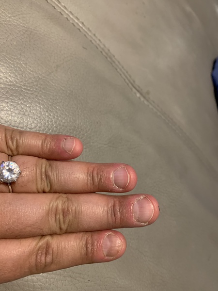 Nails
