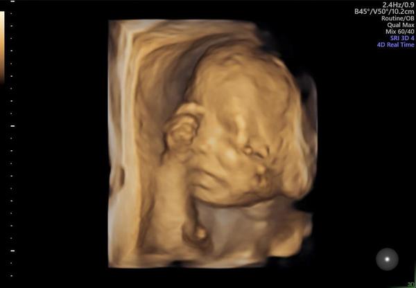 April 2022 Birth Club