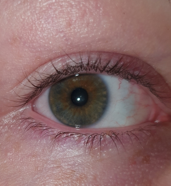 What colour are these eyes?