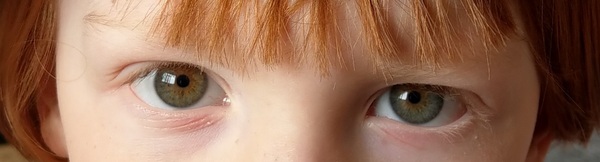 What colour are these eyes?