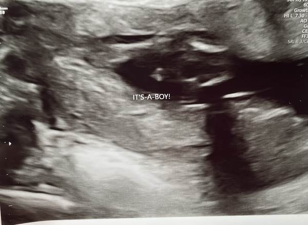 Baby gender help