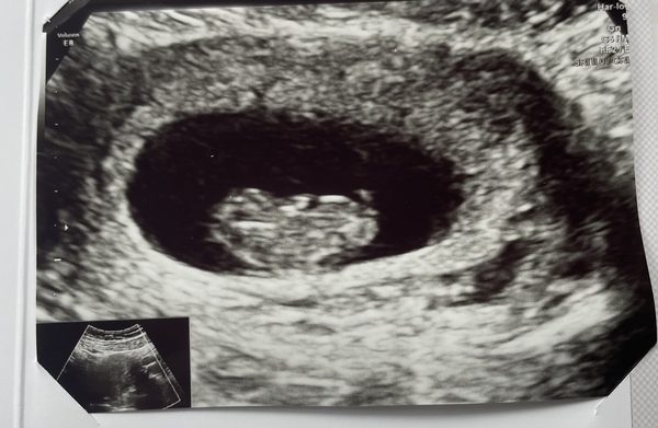Due July 2022 (thread 2)