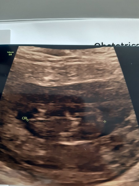 Does this 9w 6d scan look OK?