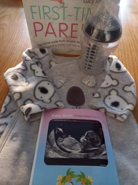 Baby has a disproportionate head?