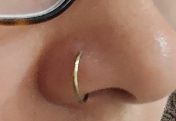 Is this infected?