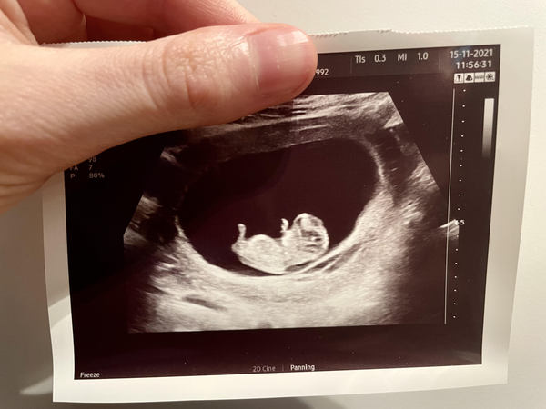 Due June 2022 (thread three)