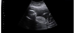 🤰🏼April 2022 Birth thread 🤰🏼