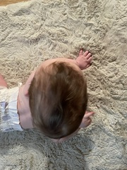 concern for 7 month old baby skull