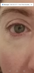 To ask what could be wrong with my eyes?