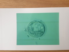 IVF/FET October/November 21