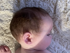 concern for 7 month old baby skull