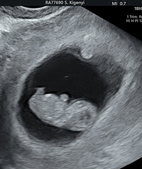 Does this 9w 6d scan look OK?