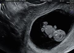 Does this 9w 6d scan look OK?