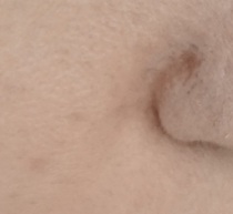 Fix my skin!
