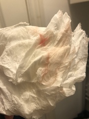 Implantation bleeding