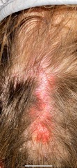 Infected skin not clearing up!