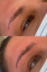What can I do about my eye brows and lashes?