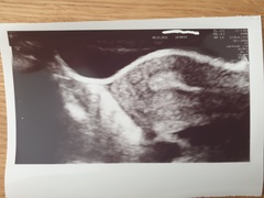 IVF/FET October/November 21