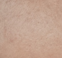 Fix my skin!