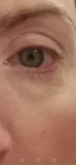 To ask what could be wrong with my eyes?