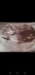 Skill theory for fun, not finding out sex until birth 😊