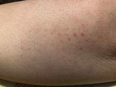 Are these bites on my dd? Going crazy over it!