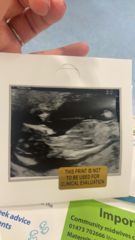 Confused about 12 week scan