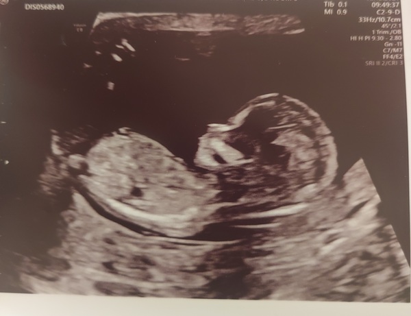 Due June 2022 (thread five)