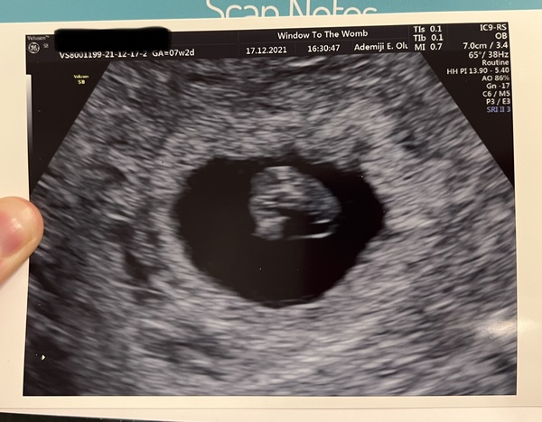 Due July/August 2022