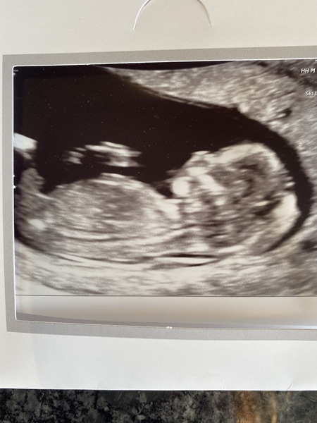 Any guesses? Boy or girl?