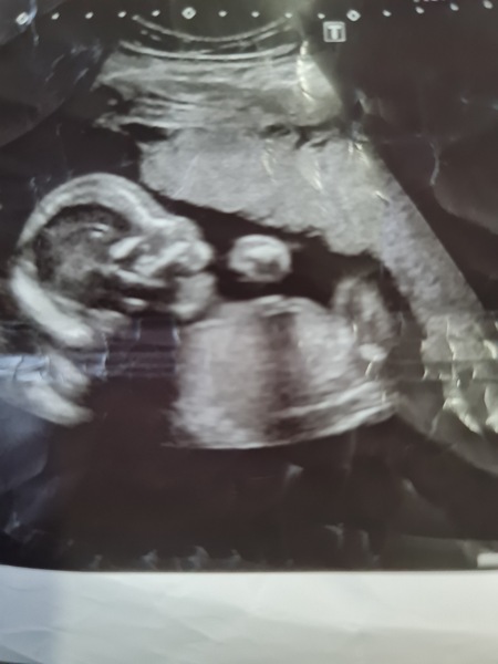 Scan pic - anyone guess gender?