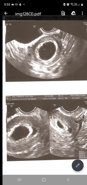 Due July 2022 (thread 2)