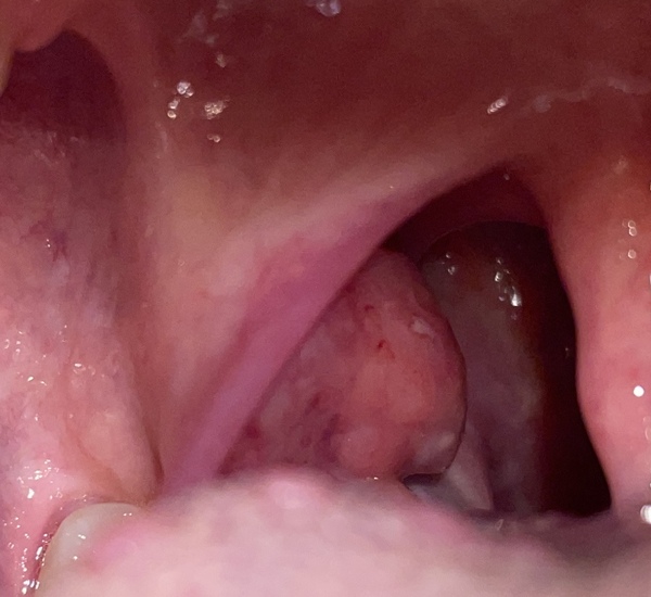 Can I see the dentist about a potential throat infection?