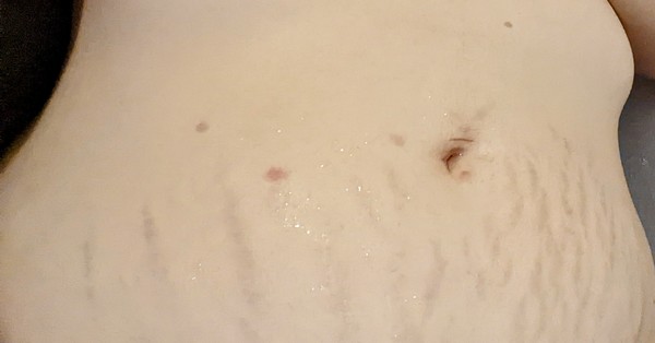 Weird spots appearing..?!
