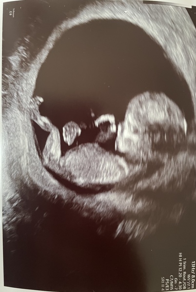 Due July 2022 (thread 2)
