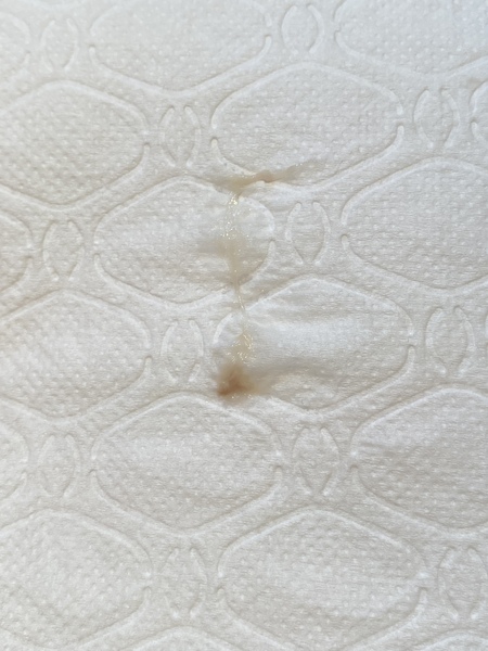 NSFW - photo of tissue/discharge - brown spot 9dpo?
