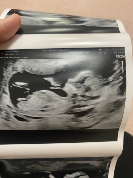 Due July 2022 (thread 2)