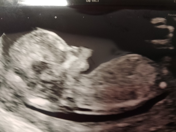 Boy or girl?