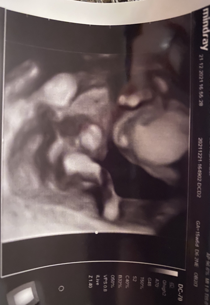 Due June 2022 (thread five)