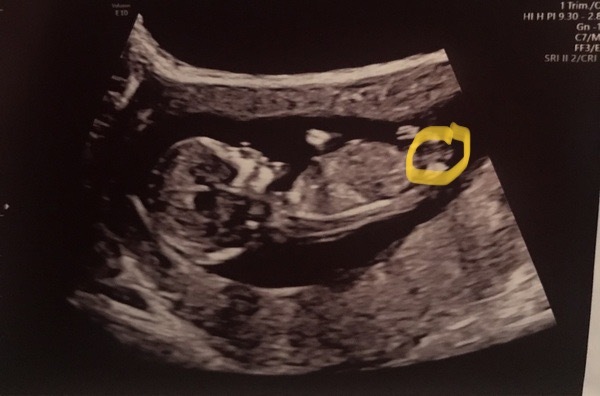 Help me find the nub? And what do you think?