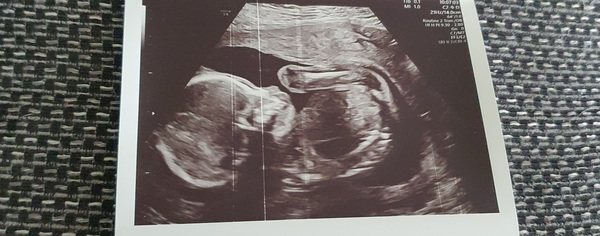 Anyone else 5 weeks pregnant?