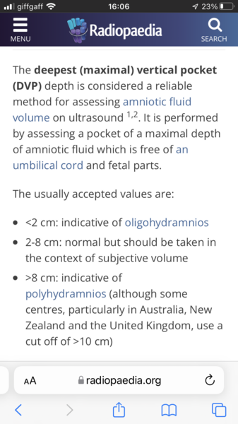 Experience with induction due to polyhydramnious (Chelsea & Westminster)