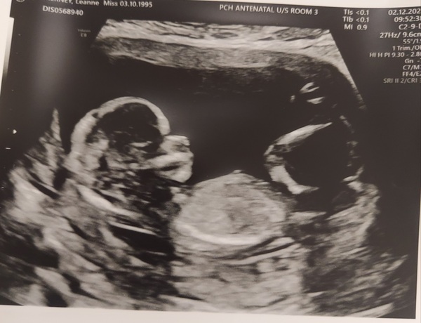Due June 2022 (thread four)