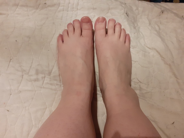 Help! Do I need an X-ray?