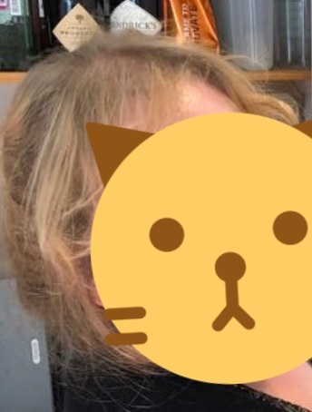 What to do about thin hair?