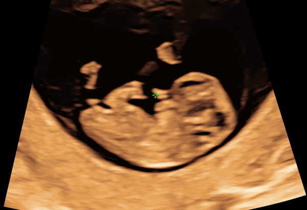 nub theory - guesses on gender?